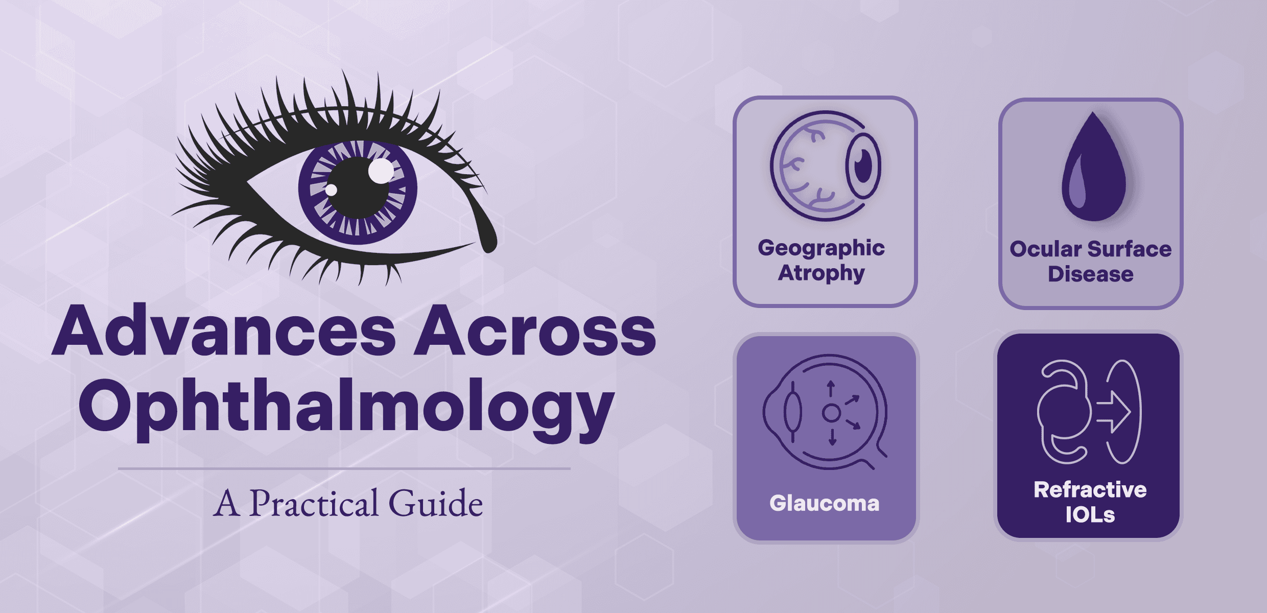 Advances Across Ophthalmology: A Practical Guide to Geographic Atrophy, Ocular Surface Disease, Glaucoma, and Refractive IOL Surgery